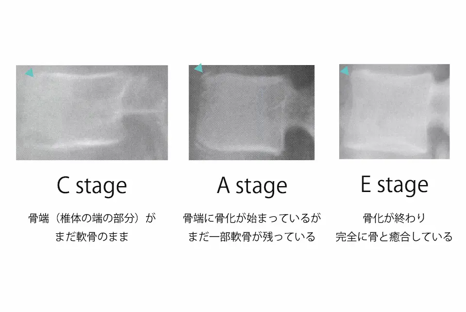 椎体の成長
