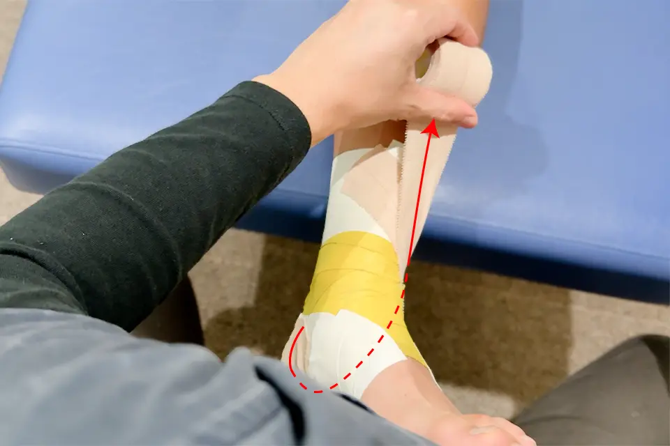 足関節捻挫のテーピング（踵骨内反制動テープ２）