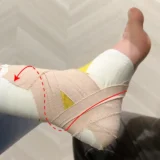 足関節捻挫のテーピング（距骨前方偏位制動テープ）