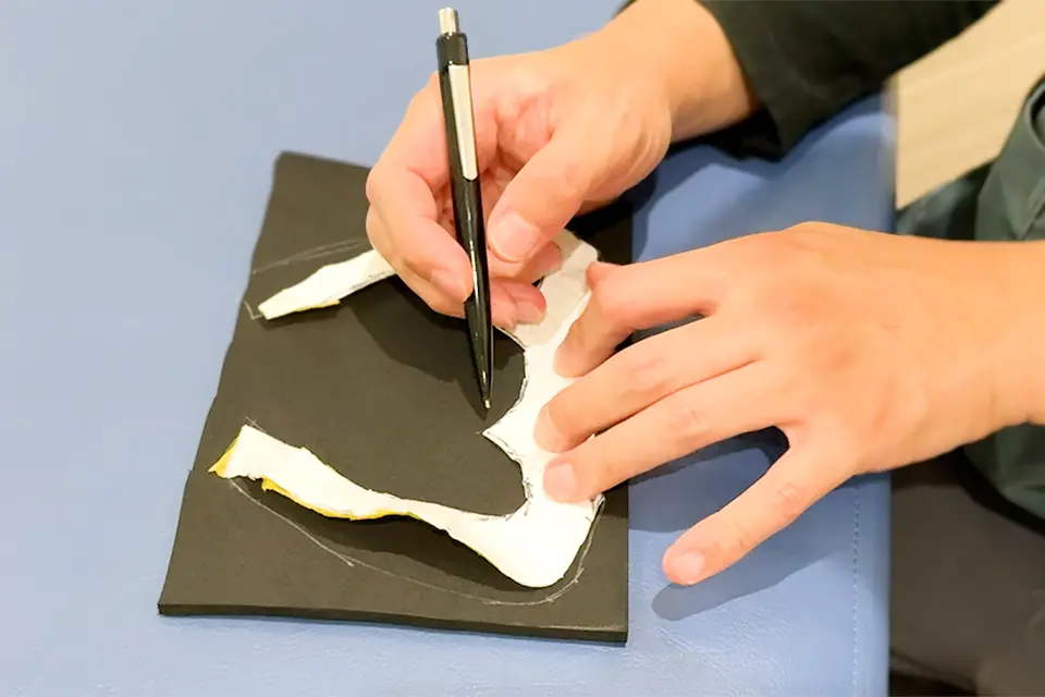 捻挫後の腫れに対する対応