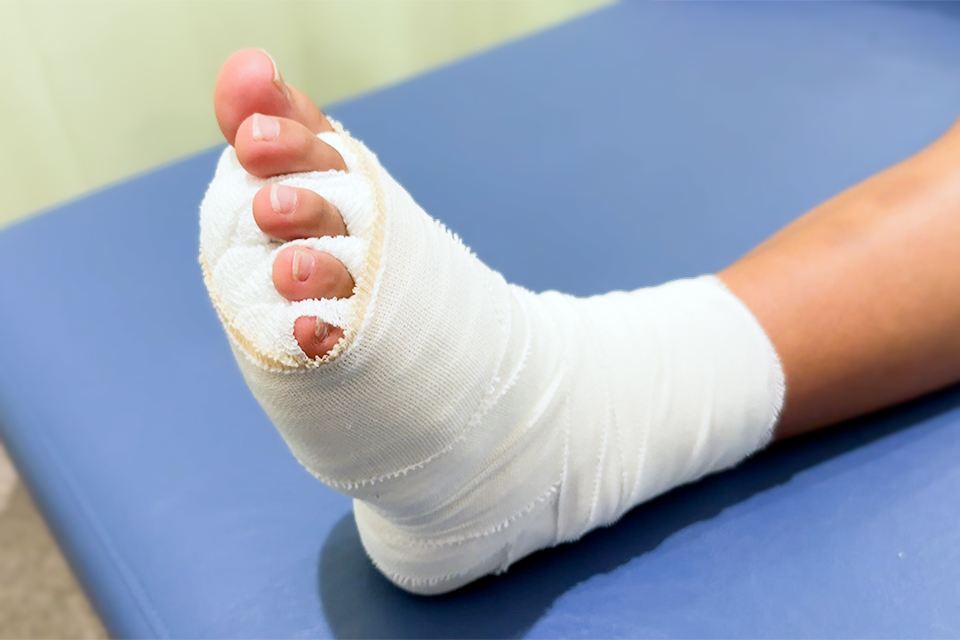 捻挫後の腫れに対する対応