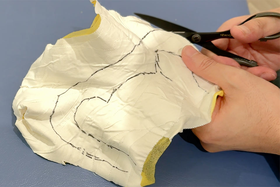 捻挫後の腫れに対する対応