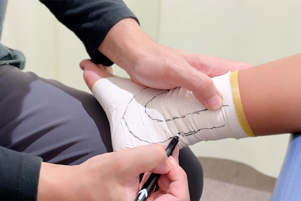 捻挫後の腫れに対する対応