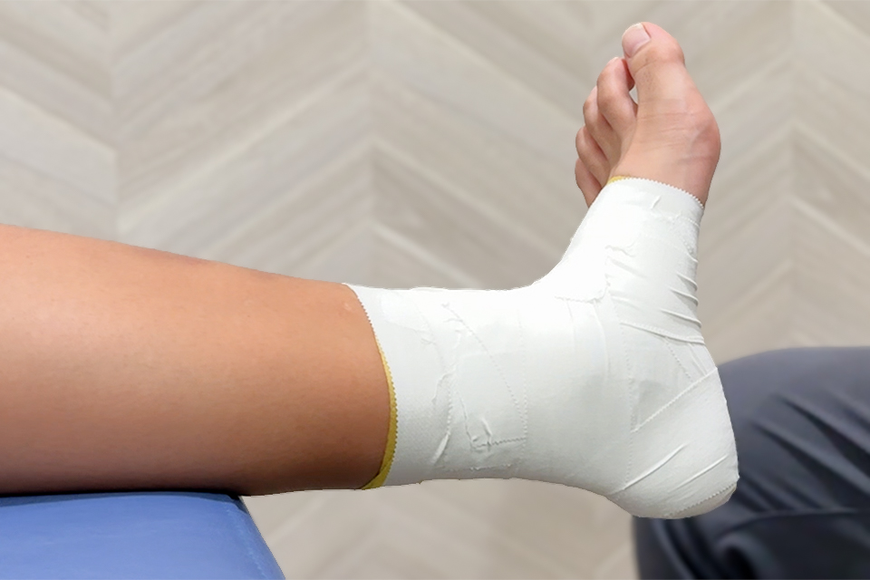 捻挫後の腫れに対する対応