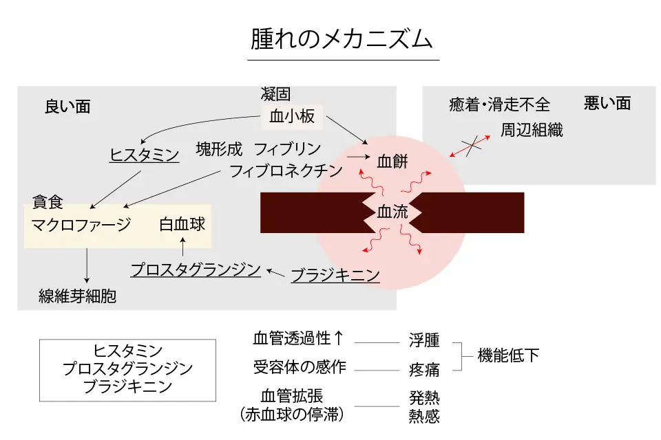 腫れのメカニズム