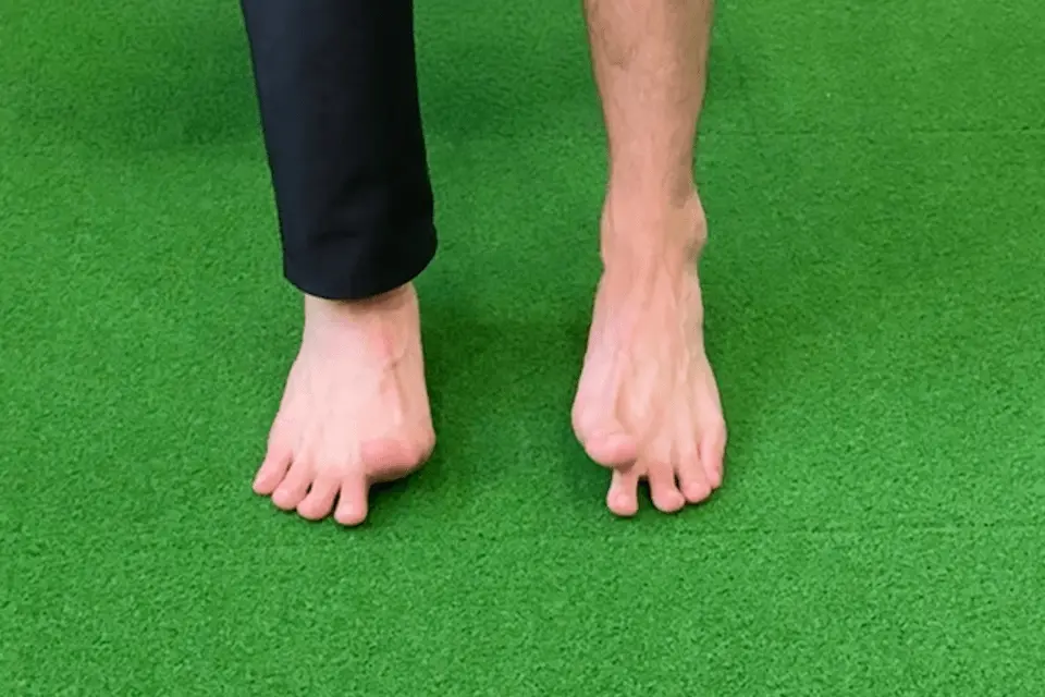 足部内在筋２