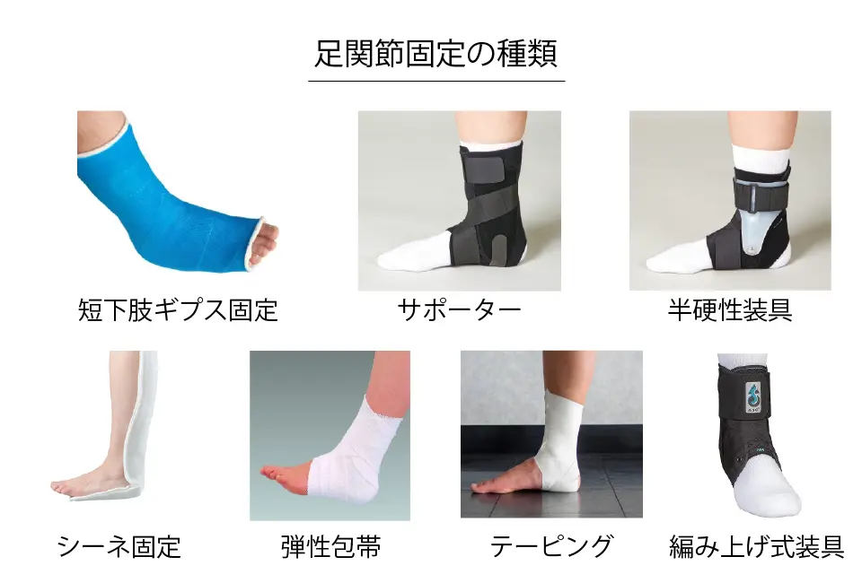 足関節固定の種類