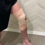 前十字靱帯損傷のための最適テーピング｜専門家が教える正しいテーピング手順