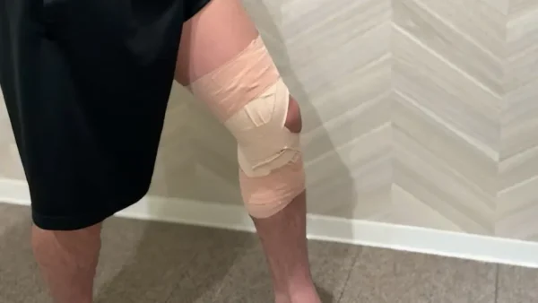 前十字靱帯損傷のための最適テーピング｜専門家が教える正しいテーピング手順