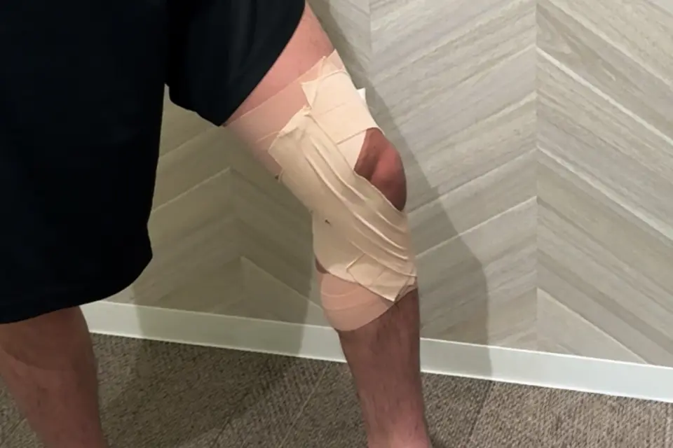 ACL損傷のテーピング④