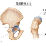 金沢市で股関節唇損傷のリハビリなら｜痛み・引っかかり感に対応