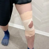 【保存版】半月板損傷のための膝テーピングガイド｜貼り方・注意点を徹底解説