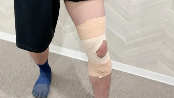 【保存版】半月板損傷のための膝テーピングガイド｜貼り方・注意点を徹底解説