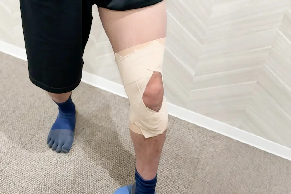 半月板損傷のテーピング