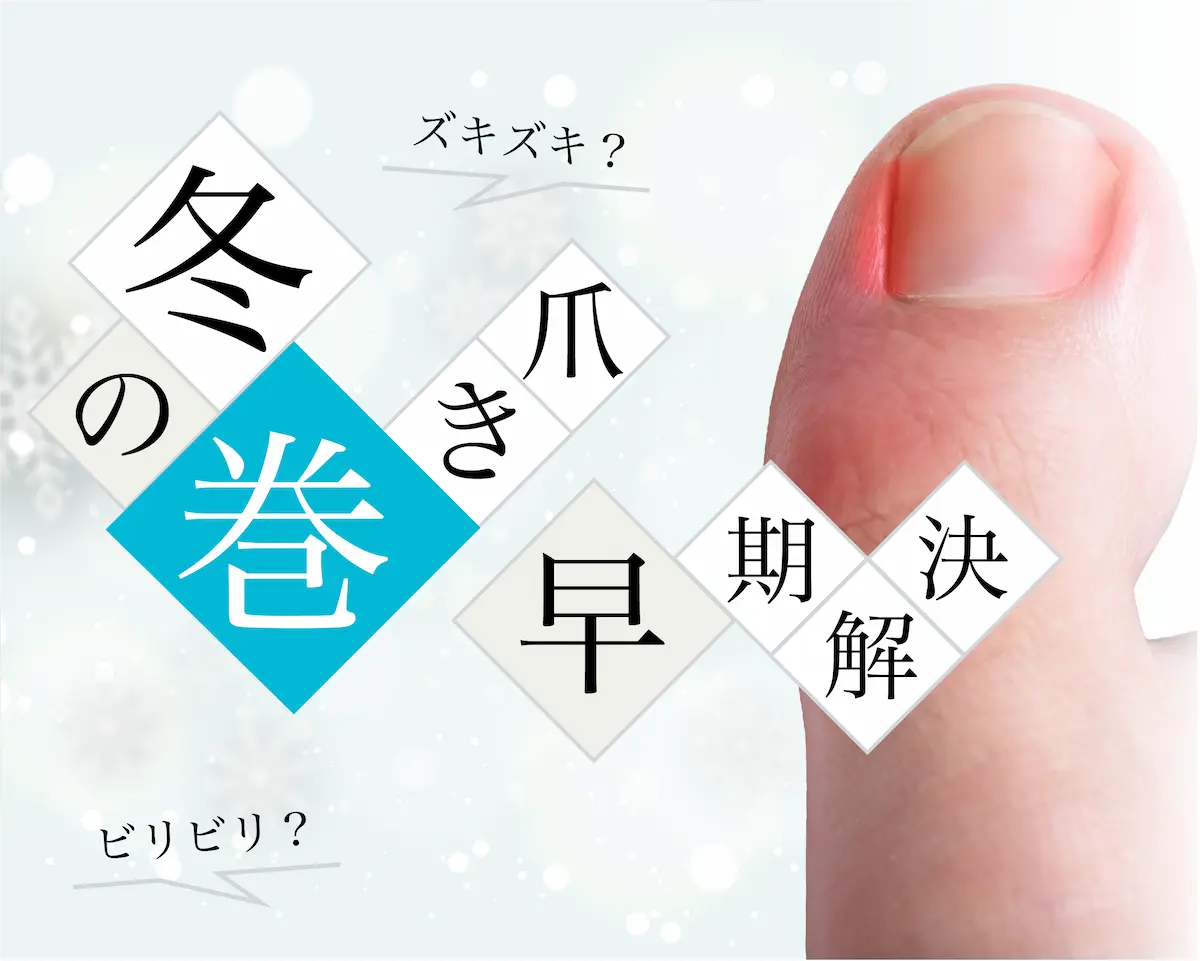 冬の巻き爪FV（スマホ）