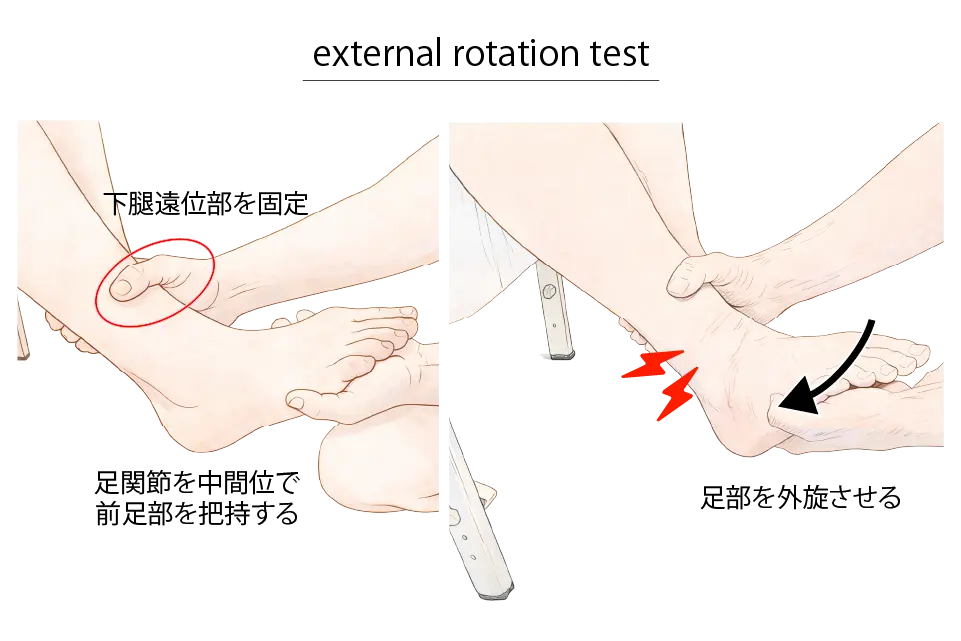 external rotation test