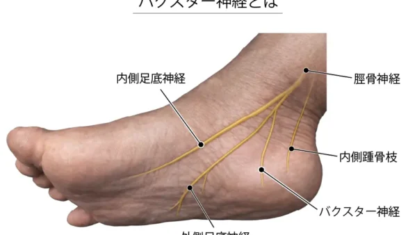 治らない踵の痛みは神経が原因？バクスター神経障害の原因や治療・テーピングなど