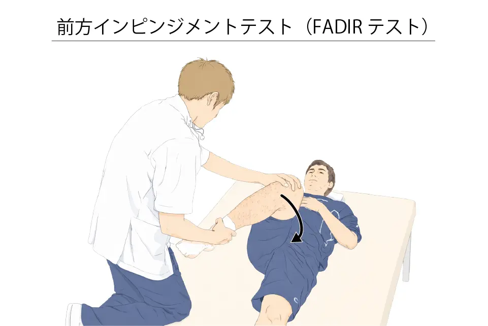 前方インピンジメントテスト（FADIRテスト）