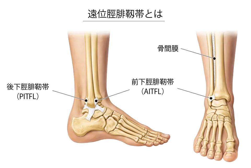 遠位脛腓靭帯とは