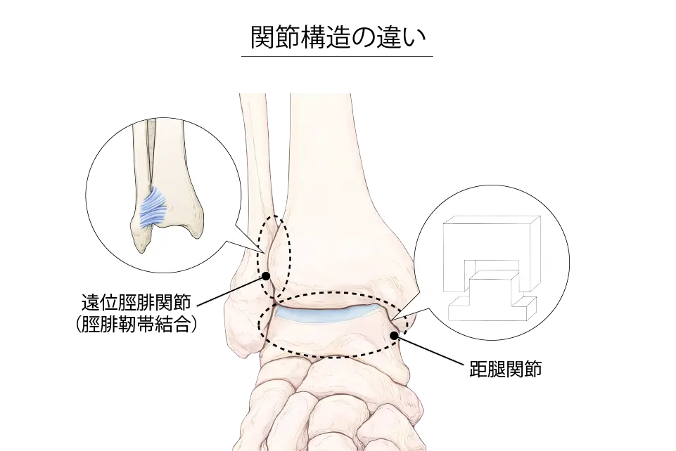 関節構造の違い