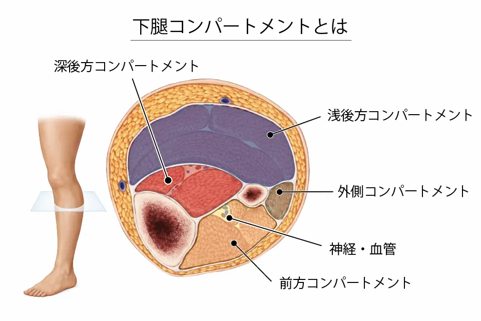 下腿コンパートメントとは