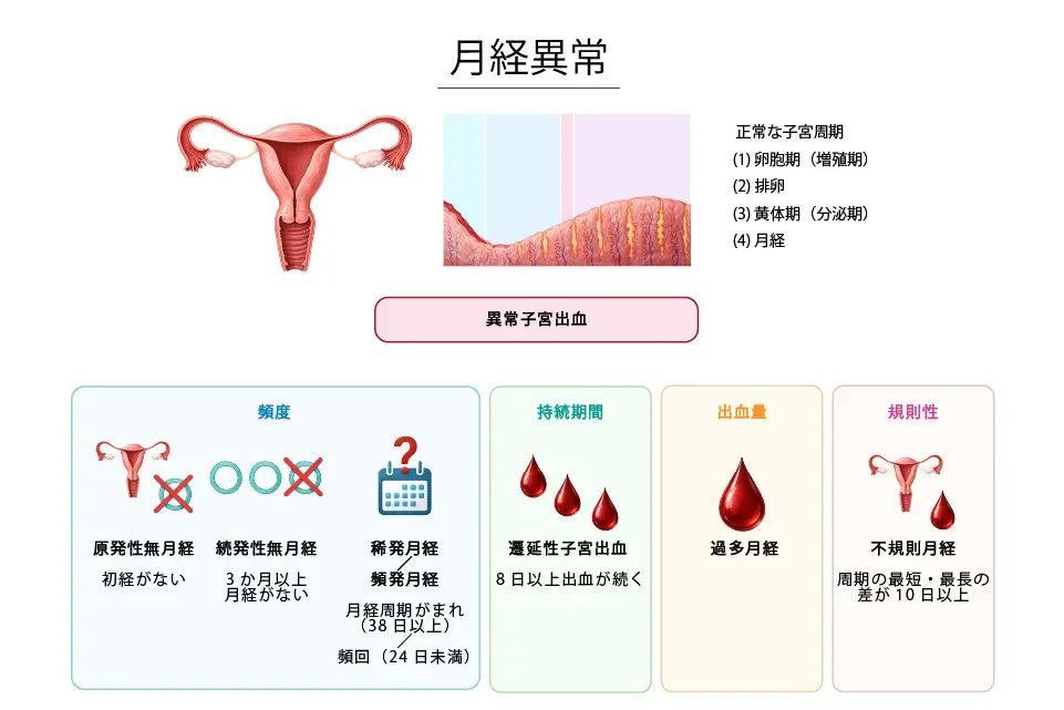 月経異常