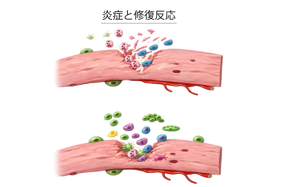 炎症と修復反応