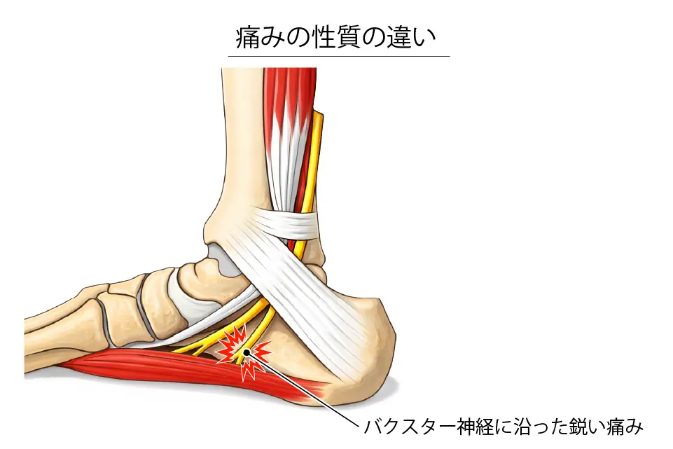 痛みの性質の違い