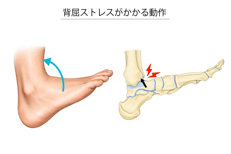背屈ストレスがかかる動作
