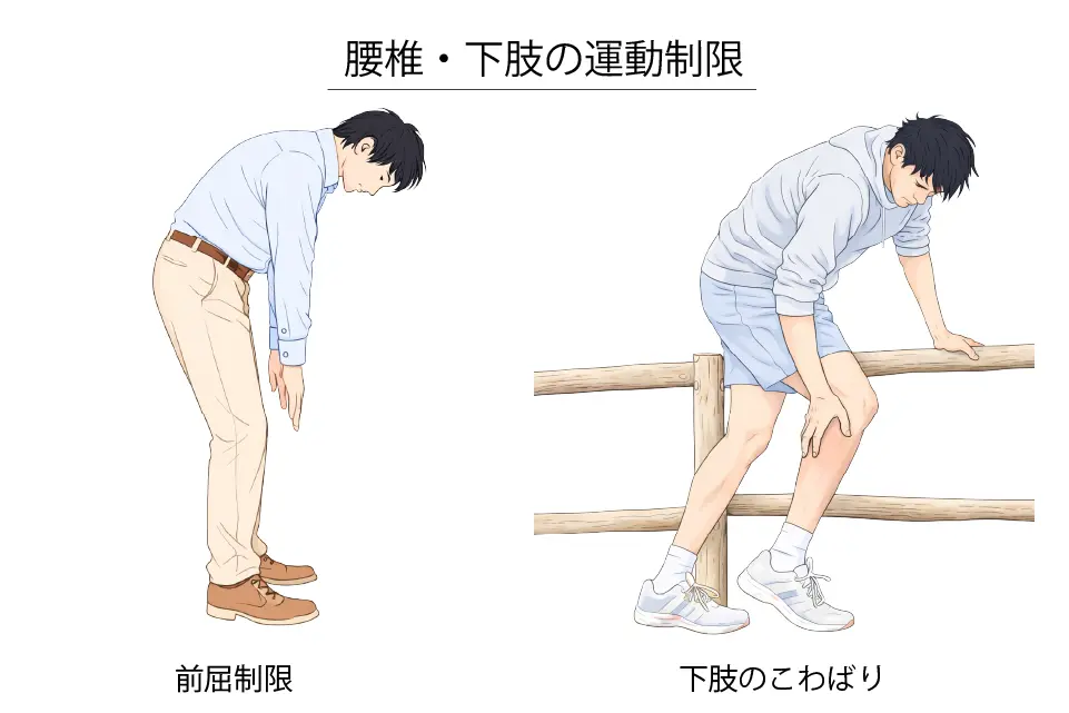 腰椎・下肢の運動制限