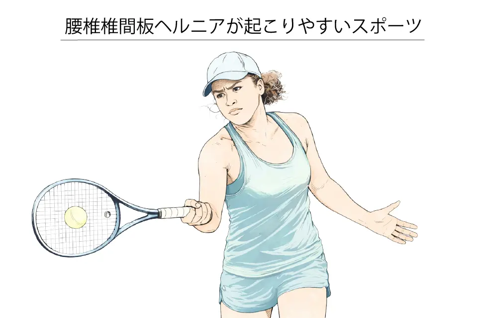 腰椎椎間板ヘルニアが起こりやすいスポーツ（テニス）