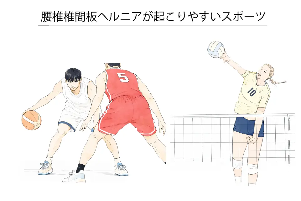 腰椎椎間板ヘルニアが起こりやすいスポーツ（バスケ・バレー）