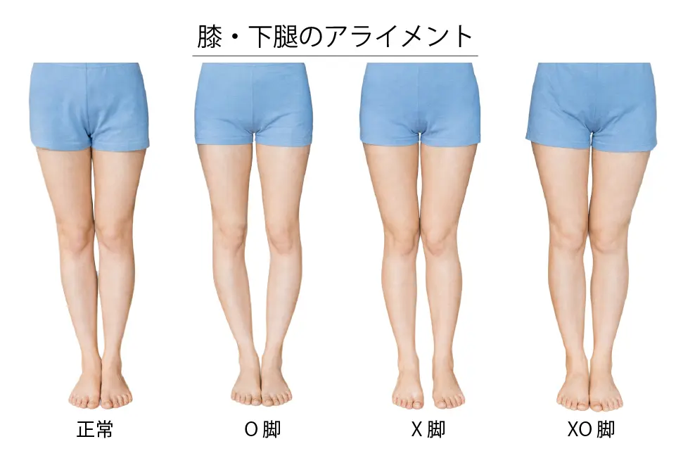 膝・下腿のアライメント