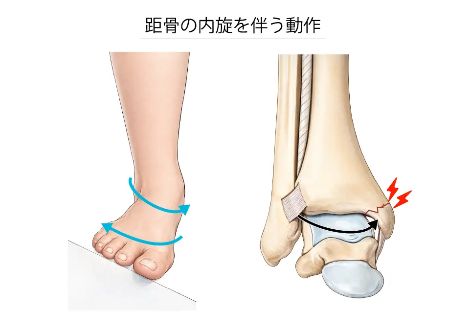 距骨の内旋を伴う動作