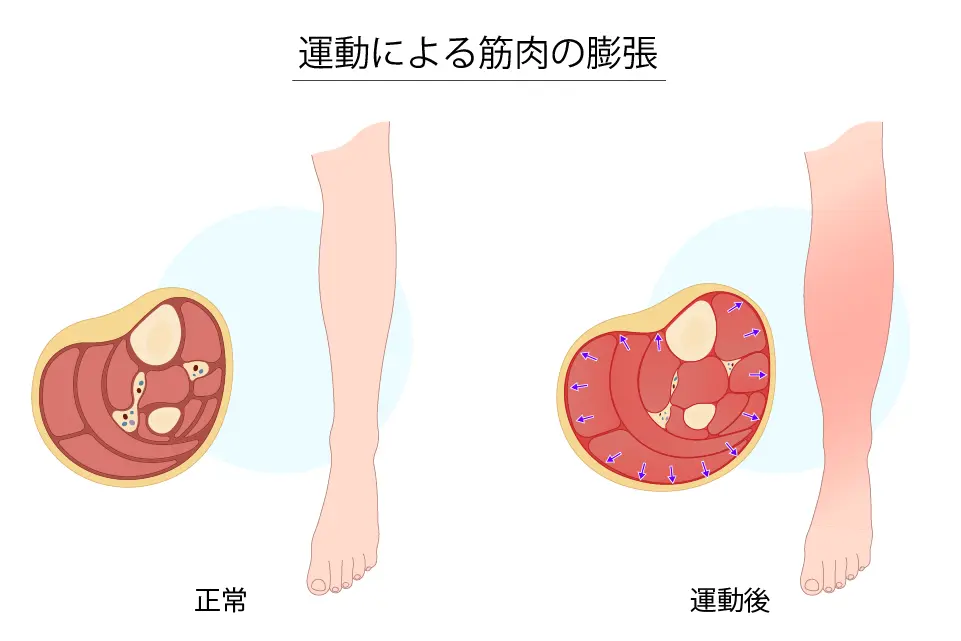 運動による筋肉の膨張