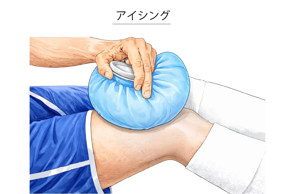 骨化性筋炎（アイシング）