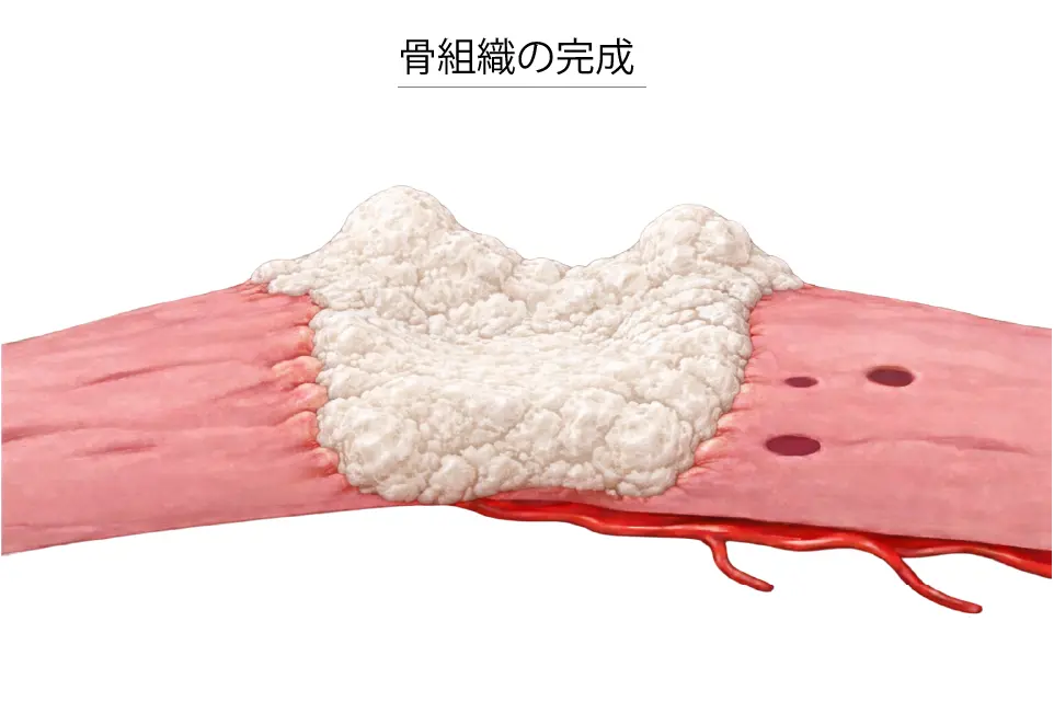 骨組織の完成