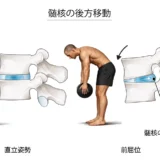 腰椎椎間板ヘルニアは自然に治る？症状の特徴と正しい対処法