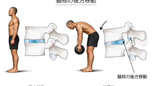 腰椎椎間板ヘルニアは自然に治る？症状の特徴と正しい対処法