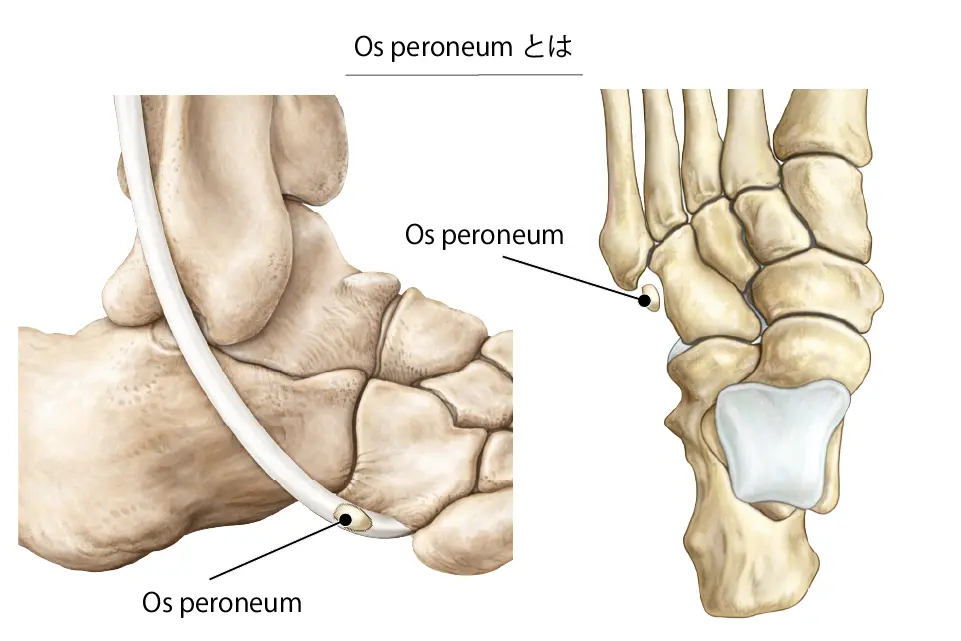 Os peroneumとは２