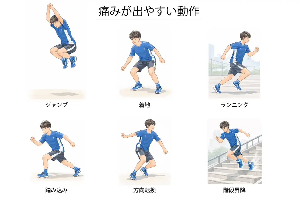 ジャンパー膝で痛みの出やすい動作