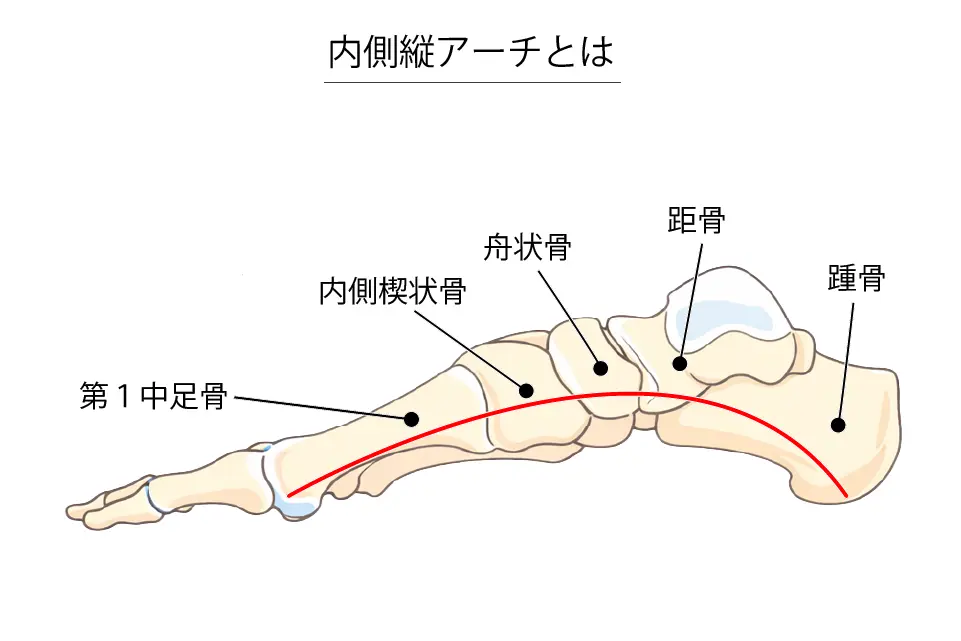 内側縦アーチとは
