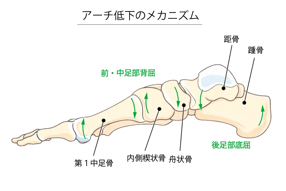 内側縦アーチ低下のメカニズム (1)