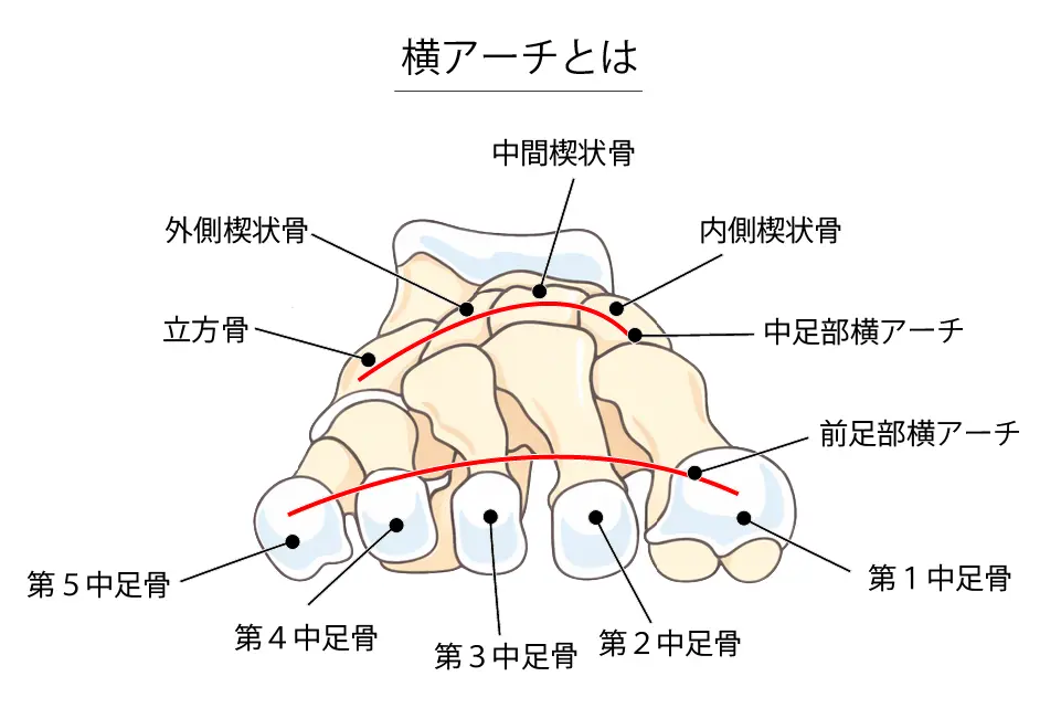横アーチとは