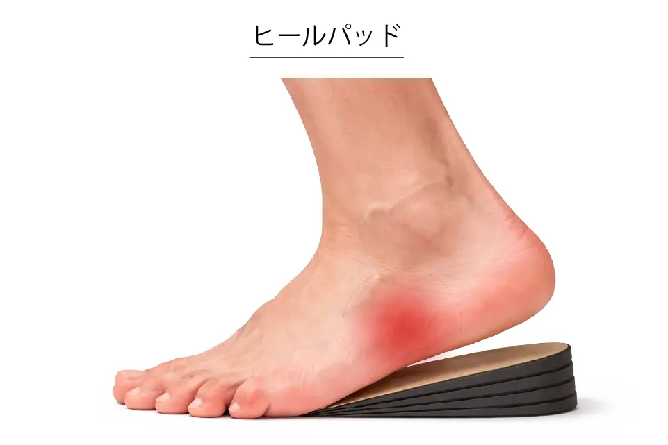 短腓骨筋腱付着部炎に対するヒールパッド