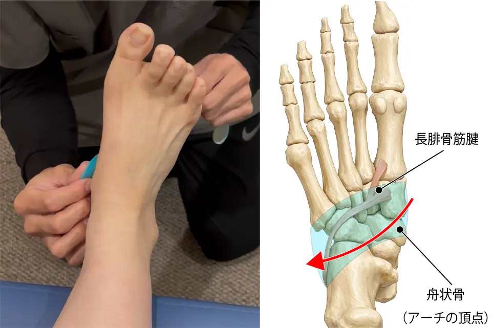 腓骨筋テーピング①