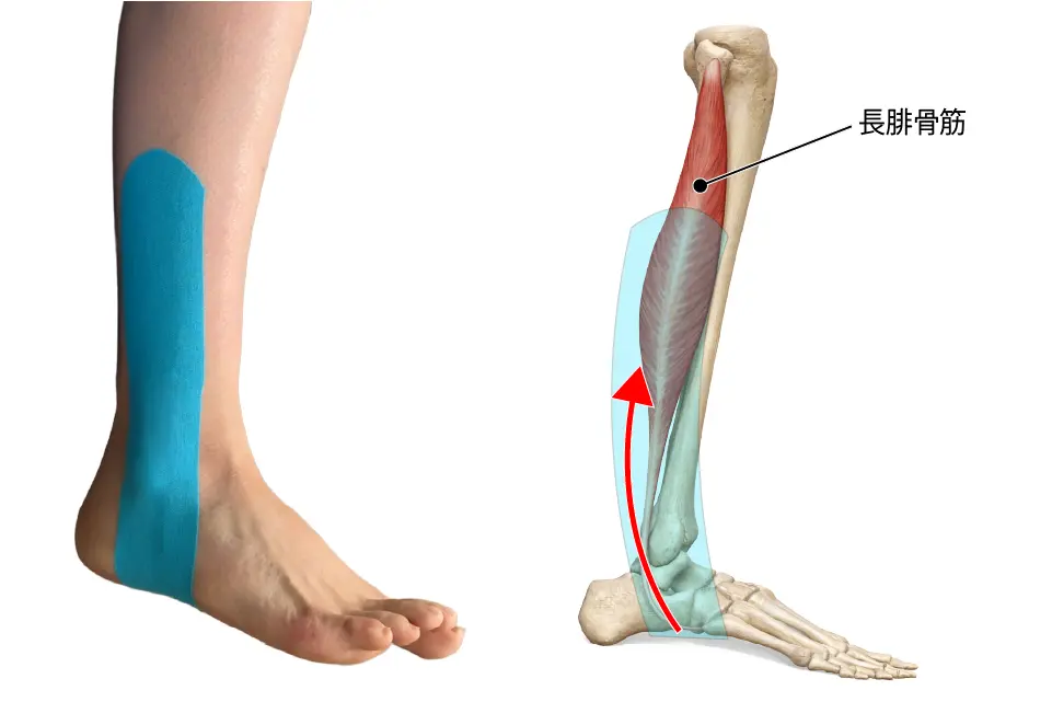 腓骨筋テーピング②