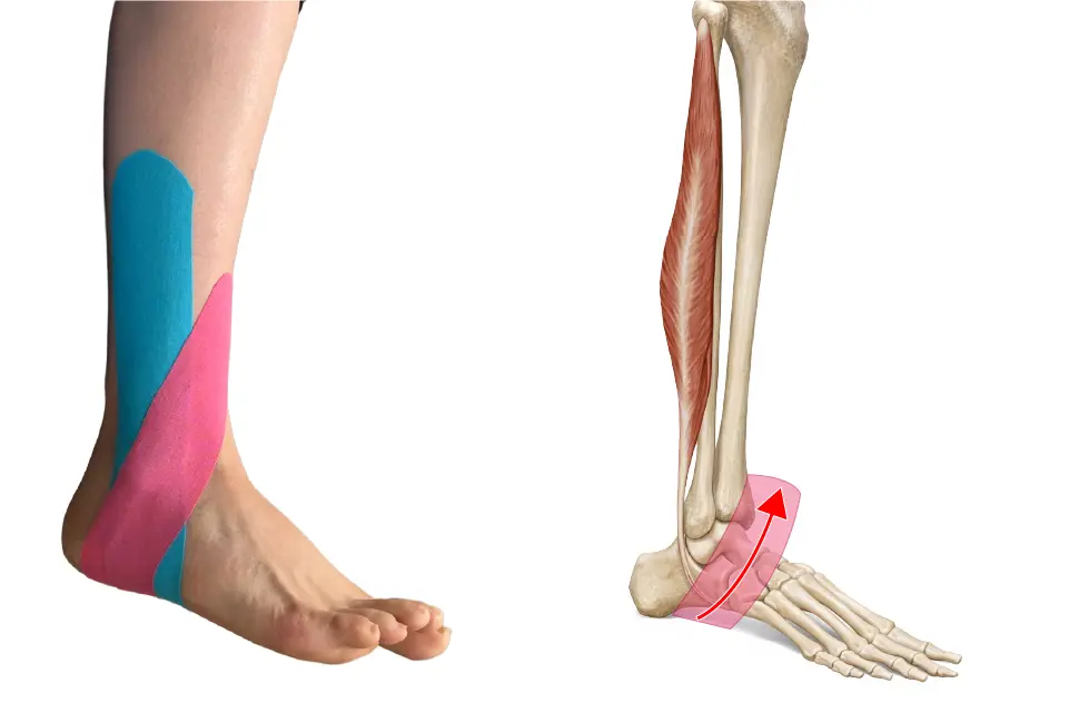 腓骨筋テーピング③