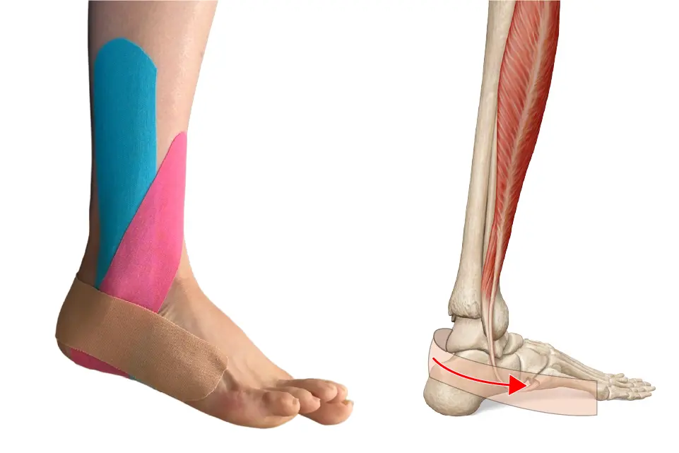 腓骨筋テーピング④