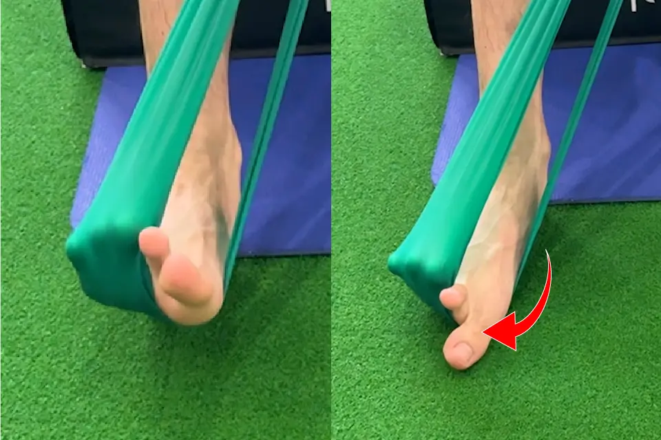 腓骨筋腱リハビリ③